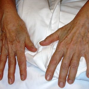 chirurgie de la mainn paris